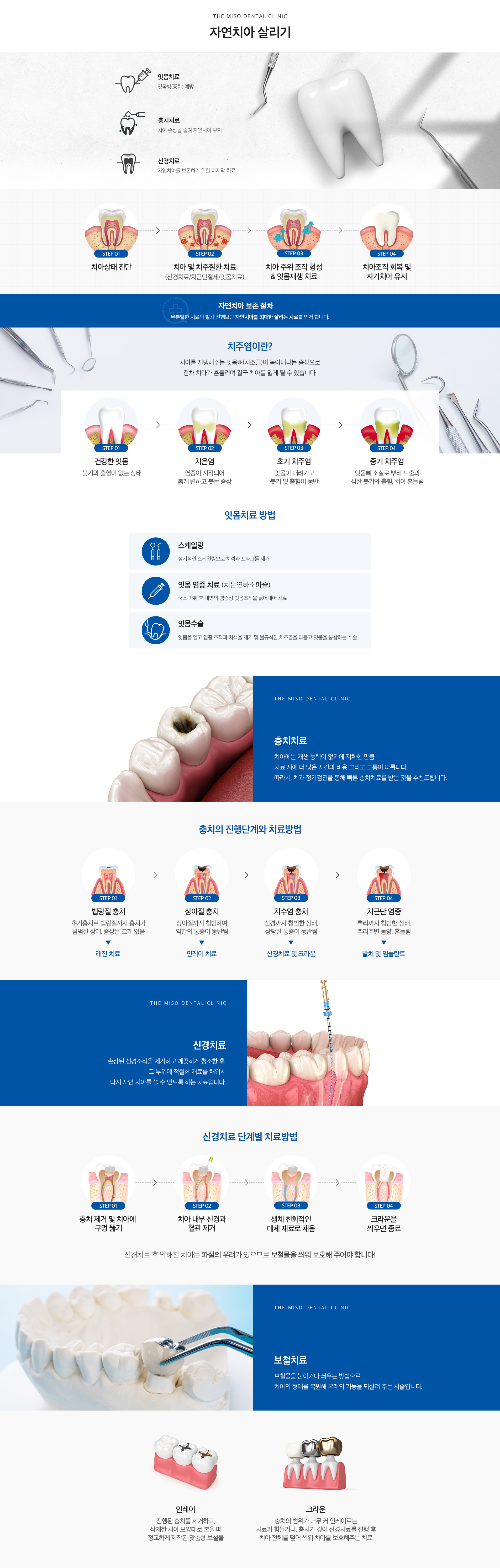 자연치아 살리기