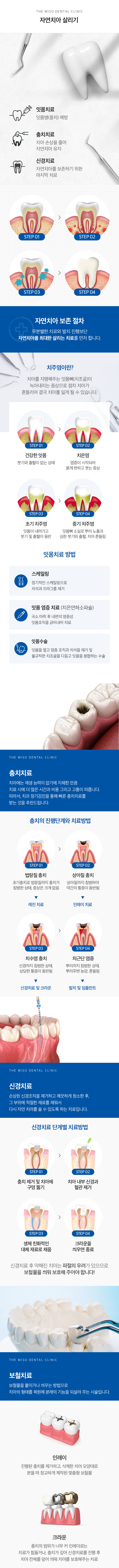 자연치아 살리기